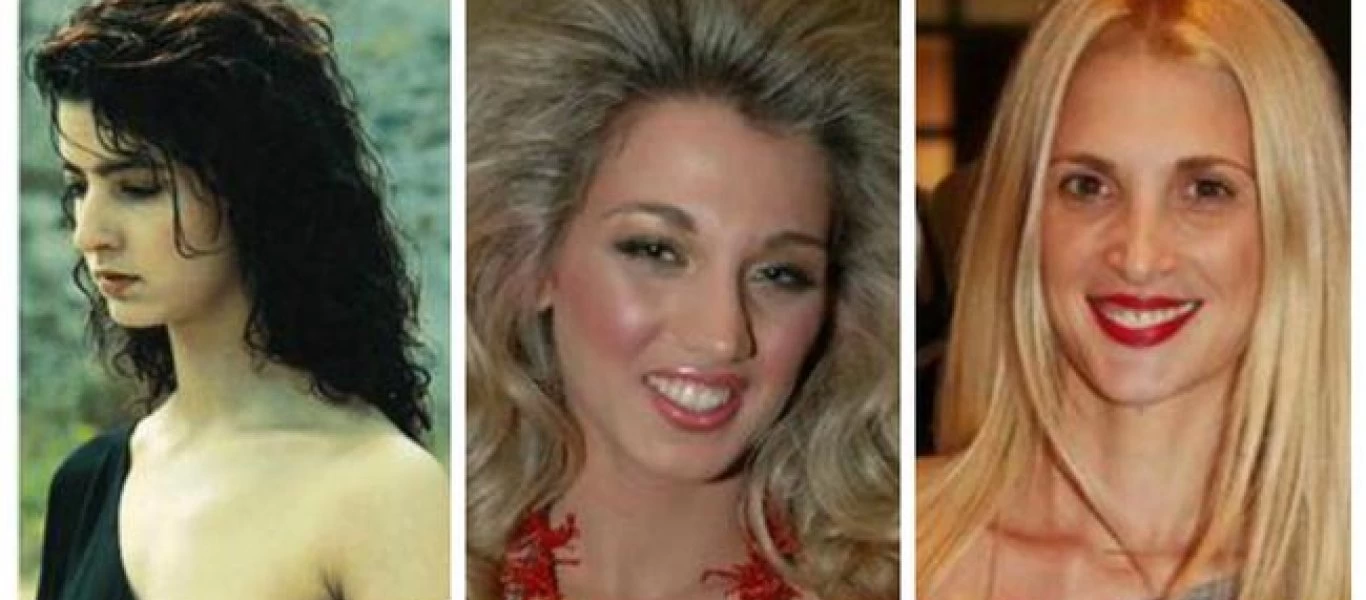 Ελληνίδες celebrities πριν και μετά την πλαστική μύτης (φωτο)